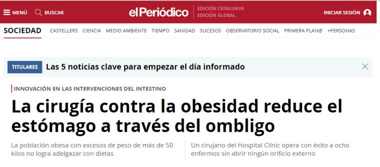 2009-10-25. El Periodico. Cirugía contra la obesidad extrayendo el estómago por el ombligo