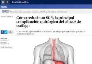 2018-12-03. La Vanguardia. Verde de indocianina en el cáncer de esófago